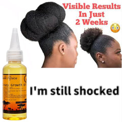 Best selling- Hair growth Strengthening Oil -Rosemary, Cloves, Chebe Oil and more