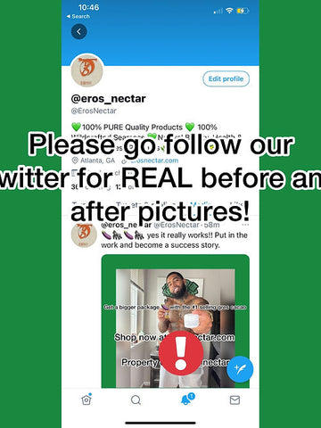 Get Support for Low Testosterone Symptoms